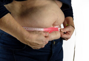 obesity